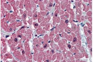 Human Heart: Formalin-Fixed, Paraffin-Embedded (FFPE) (TNNC1 抗体  (AA 1-162))