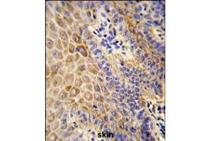 Formalin-fixed and paraffin-embedded human Skin reacted with GC Antibody , which was peroxidase-conjugated to the secondary antibody, followed by DAB staining. (Gc (AA 337-365) 抗体)