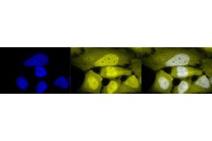 Immunocytochemistry/Immunofluorescence analysis using Rabbit Anti-Phosphoserine Polyclonal Antibody (ABIN361725). (Phosphoserine 抗体)