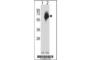 Western blot analysis of MMP2 using rabbit polyclonal MMP2 Antibody using 293 cell lysates (2 ug/lane) either nontransfected (Lane 1) or transiently transfected (Lane 2) with the MMP2 gene. (MMP2 抗体  (AA 303-331))