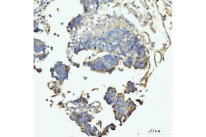 IHC analysis of GRPEL1 using anti-GRPEL1 antibody (ABIN7602643). (GRPEL1 抗体  (AA 90-217))