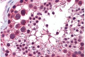 Human Testis: Formalin-Fixed, Paraffin-Embedded (FFPE) (HDAC6 抗体  (N-Term))