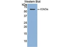 Detection of Recombinant CTSA, Human using Polyclonal Antibody to Cathepsin A (CTSA) (CTSA 抗体  (AA 215-470))