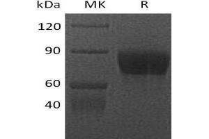 Western Blotting (WB) image for Colony Stimulating Factor 1 Receptor (CSF1R) protein (Fc Tag) (ABIN7320965) (CSF1R Protein (Fc Tag))