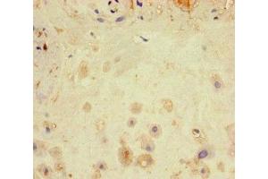 Immunohistochemistry of paraffin-embedded human placenta tissue using ABIN7169059 at dilution of 1:100 (LATS1 抗体  (AA 1-280))