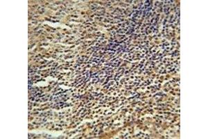 MEF2A antibody immunohistochemistry analysis in formalin fixed and paraffin embedded human tonsil tissue. (MEF2A 抗体  (AA 453-479))