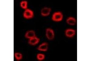 Immunofluorescent analysis of N-WASP staining in SW480 cells. (Neural Wiskott-Aldrich syndrome protein (WASL) 抗体)