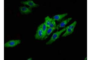 Immunofluorescent analysis of Hela cells using ABIN7142618 at dilution of 1:100 and Alexa Fluor 488-congugated AffiniPure Goat Anti-Rabbit IgG(H+L) (Serotonin Receptor 1E 抗体  (AA 203-291))