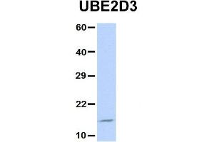 Host:  Rabbit  Target Name:  UBE2D3  Sample Type:  Jurkat  Antibody Dilution:  1. (UBE2D3 抗体  (N-Term))