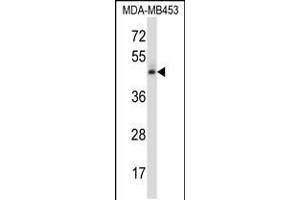 Western blot analysis in MDA-MB453 cell line lysates (35ug/lane). (NR2F1 抗体  (N-Term))