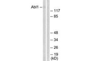 Western blot analysis of extracts from COS7 cells, treated with Adriamycin 0. (ABL1 抗体  (AA 156-205))