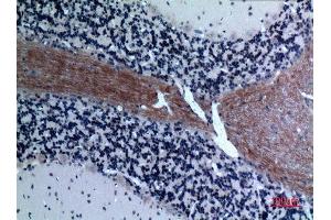 Immunohistochemistry (IHC) analysis of paraffin-embedded Rat Brain, antibody was diluted at 1:100. (CCL26 抗体  (Internal Region))