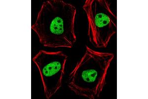 Fluorescent image of Hela cells stained with TLE1 Antibody (N-term) (ABIN6244026 and ABIN6577784).