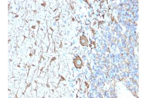 Formalin-fixed, paraffin-embedded human Cerebellum stained with Neurofilament Rabbit Recombinant Monoclonal Antibody (NEFL. (Recombinant NEFH 抗体)