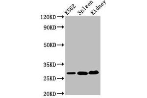 Western Blot Positive WB detected in: K562 whole cell lysate, Mouse spleen tissue, Mouse kidney tissue All lanes: CA1 antibody at 6. (CA1 抗体  (AA 2-261))