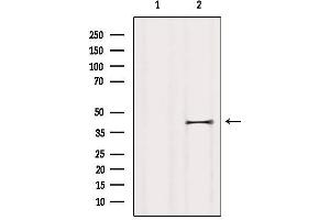 Western blot analysis of extracts from HUVEC, using P2RY5 Antibody. (LPAR6 抗体  (Internal Region))