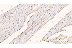 Detection of ALB in Rat Cardiac Muscle Tissue using Polyclonal Antibody to Albumin (ALB) (Albumin 抗体)