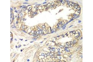 Immunohistochemistry of paraffin-embedded Human prostate using SLC4A4 / NBC Polyclonal Antibody at dilution of 1:100 (40x lens). (SLC4A4 抗体)