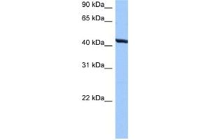 WB Suggested Anti-TMEM118 Antibody Titration:  0. (RNFT2 抗体  (N-Term))