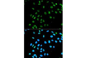 Immunofluorescence analysis of MCF7 cell using MNAT1 antibody. (MNAT1 抗体)