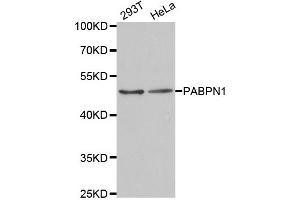 Western Blotting (WB) image for anti-Poly A Binding Protein Nuclear 1 (PABPN1) antibody (ABIN1877070) (PABPN1 抗体)