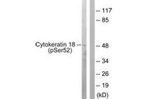 Western blot analysis of extracts from HepG2 cells, using Keratin 18 (Phospho-Ser52) Antibody. (Cytokeratin 18 抗体  (pSer52))