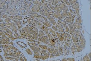 ABIN6272341 at 1/100 staining Human pancreas tissue by IHC-P. (ST14 抗体  (Internal Region))