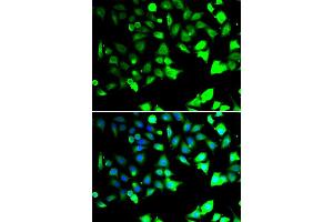 Immunofluorescence analysis of HeLa cell using XIAP antibody. (XIAP 抗体)