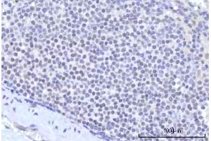 IHC analysis of RBM22 using anti-RBM22 antibody (ABIN7600268).