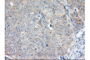 Immunohistochemical staining of paraffin-embedded Human liver tissue using anti-H6PD mouse monoclonal antibody. (Glucose-6-Phosphate Dehydrogenase 抗体)