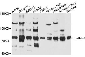 Western blot analysis of extracts of various cells, using PLXNB2 antibody. (Plexin B2 抗体)
