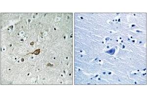 Immunohistochemistry analysis of paraffin-embedded human brain tissue, using c-Abl (Ab-412) Antibody. (ABL1 抗体  (AA 406-455))