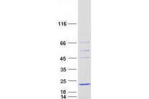 Western Blotting (WB) image for Heat Shock Protein, alpha-Crystallin-Related, B9 (HSPB9) protein (Myc-DYKDDDDK Tag) (ABIN2722578)