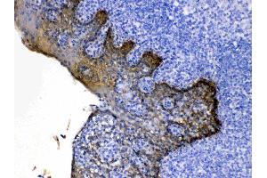 Cytokeratin 5 was detected in paraffin-embedded sections of human tonsil tissues using rabbit anti- Cytokeratin 5 Antigen Affinity purified polyclonal antibody (Catalog # ) at 1 µg/mL. (Cytokeratin 5 抗体  (Middle Region))