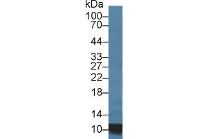 Western Blotting (WB) image for anti-S100 Calcium Binding Protein A8 (S100A8) (AA 1-89) antibody (ABIN7443995)