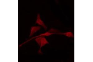 ABIN6268901 staining K562 by IF/ICC. (c-FOS 抗体  (N-Term))