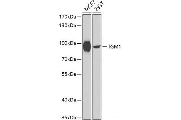 TGM1 抗体