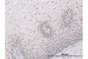 Immunostaining (ISt) image for anti-SWI/SNF Related, Matrix Associated, Actin Dependent Regulator of Chromatin, Subfamily B, Member 1 (SMARCB1) (AA 1-385) antibody (ABIN520281)