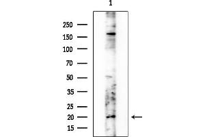 anti-Cerebellin 4 Precursor (CBLN4) (Internal Region) antibody