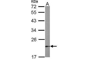 WB Image Sample (50 ug of whole cell lysate) A: mouse stomach 12% SDS PAGE antibody diluted at 1:1000 (Dual Specificity Phosphatase 3 (DUSP3) 抗体)