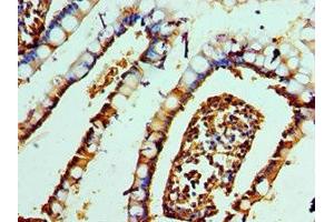 Immunohistochemistry of paraffin-embedded human small intestine tissue using ABIN7161506 at dilution of 1:100 (alpha Defensin 1 抗体  (AA 1-94))