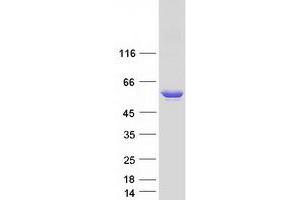 Western Blotting (WB) image for Glutamate Decarboxylase 2 (Pancreatic Islets and Brain, 65kDa) (GAD2) (Transcript Variant 2) protein (Myc-DYKDDDDK Tag) (ABIN2721540)