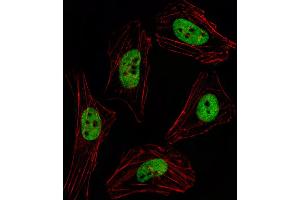 Fluorescent image of Hela cell stained with PITX2 Antibody . (PITX2 抗体  (AA 122-151))