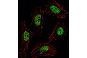 Fluorescent image of Hela cell stained with PITX2 Antibody .