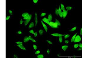 Immunofluorescence of purified MaxPab antibody to ME1 on HeLa cell. (ME1 抗体  (AA 1-572))