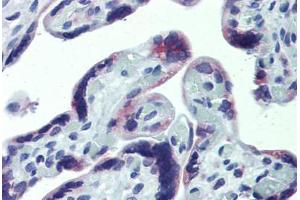 Anti-CXCR6 antibody IHC staining of human placenta. (CXCR6 抗体  (AA 82-142))