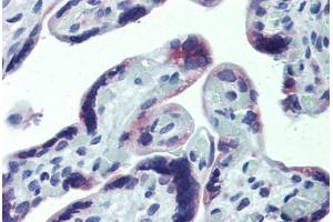 Anti-CXCR6 antibody IHC staining of human placenta. (CXCR6 抗体  (AA 82-142))
