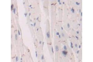 IHC-P analysis of Mouse Tissue, with DAB staining. (Insulin Receptor 抗体  (AA 1101-1372))