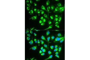 Immunofluorescence analysis of MCF7 cell using SLC22A5 antibody. (SLC22A5 抗体  (AA 1-180))