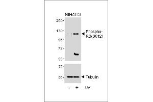 Western blot analysis of lysates from NIH/3T3 cell line, untreated or treated with UV(2h), using Phospho-RB Antibody (upper) or Tubulin (lower). (Retinoblastoma 1 抗体  (pSer612))